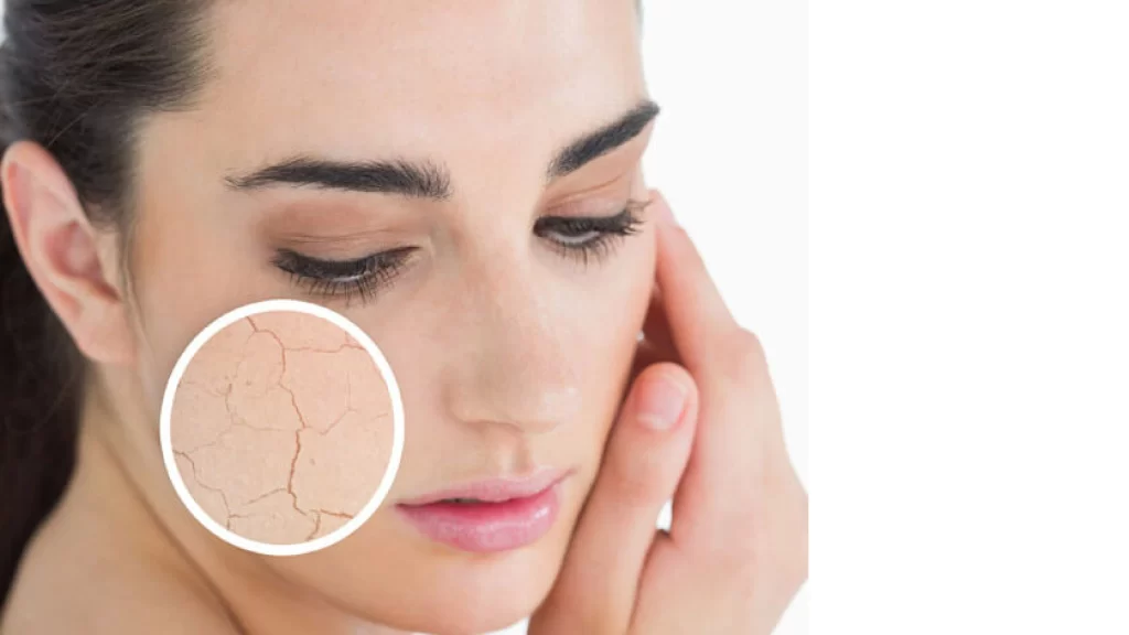 Ultimate Dry Skincare Routine
